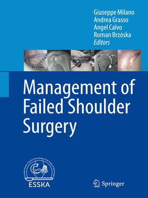 cover image of Management of Failed Shoulder Surgery